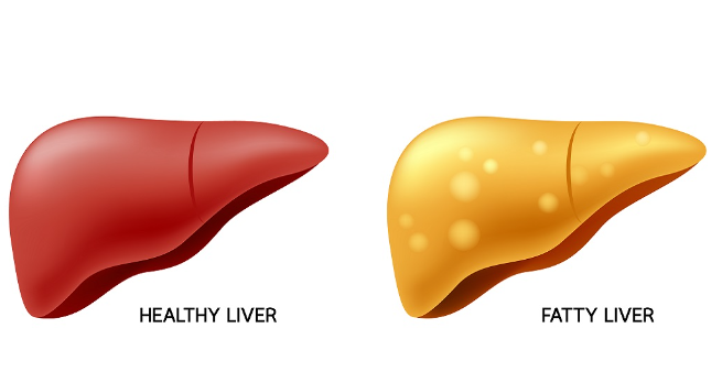 Is corn silk good for fatty liver.png